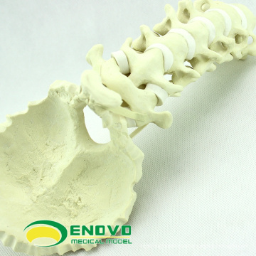 WHOLESALE SIMULATION BONE 12322 Medical Anatomy Artificial Cervical Occipital Bone , Orthopaedics Practice Simulation Bone